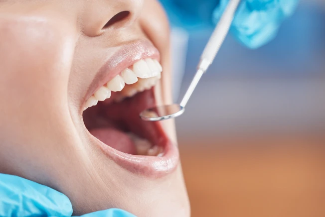 Limpeza Dental